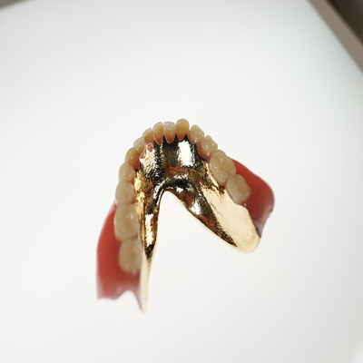 ラミネート床義歯